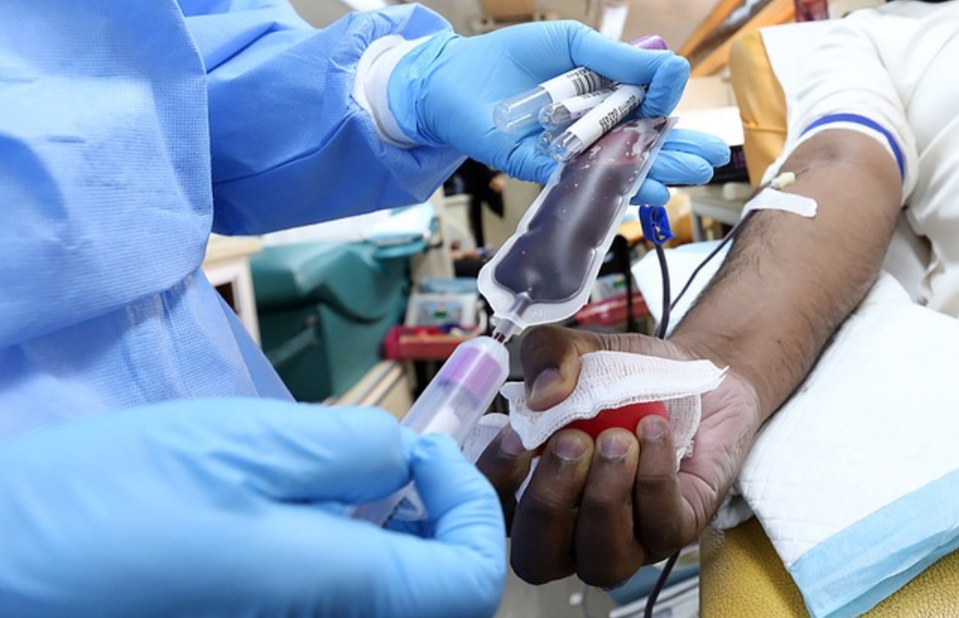 Ini 4 Manfaat Transfusi Darah yang Wajib Diketahui, Ketahui Berbagai Risikonya