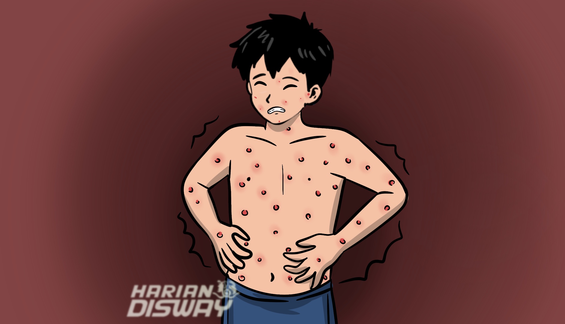 Keperkasaan Penyakit Campak