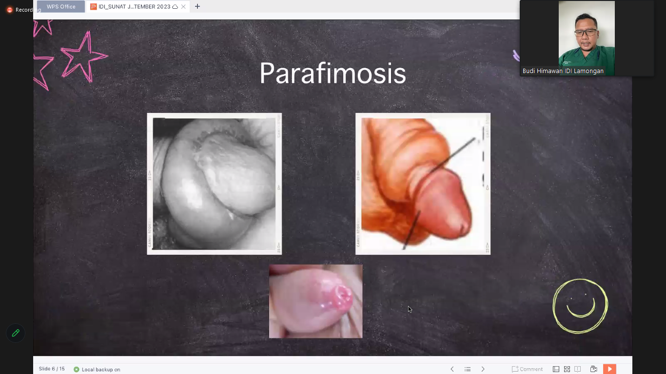 Parafimosis: Pengertian, Gejala, Pertolongan Pertama, hingga Tip Terhindar dari Kelainan Parafimosis