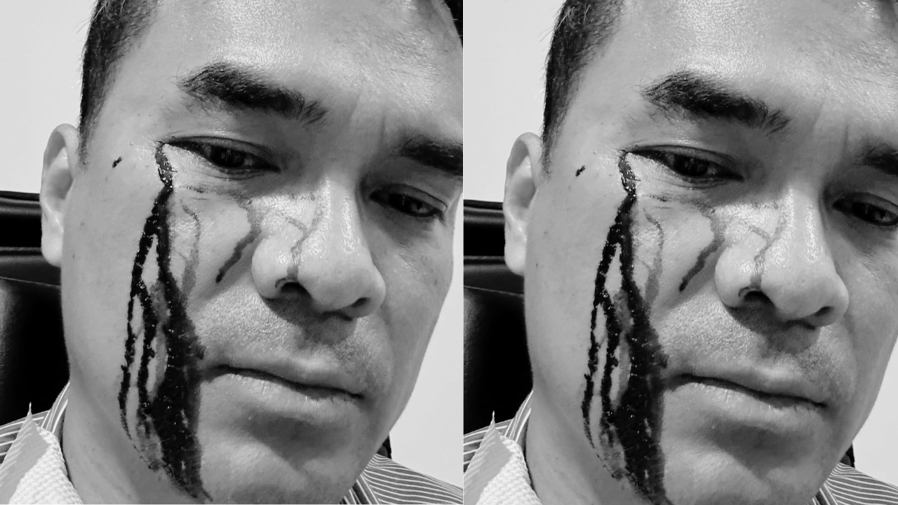 Penampakan Wajah Bro Ron Usai Dipukuli 2 Preman, Darah Mengucur di Pelipis Mata