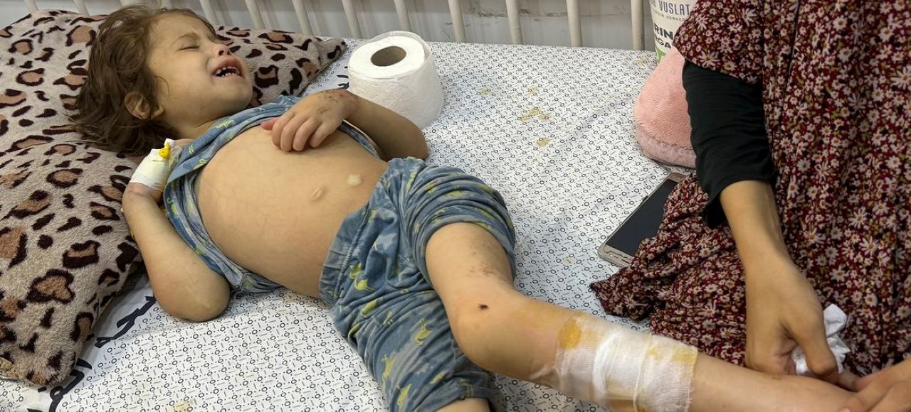 Malnutrisi di Gaza Meningkat Drastis, UNRWA Sebut Situasi Sengaja Diciptakan