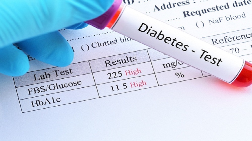Diabetes Lebih Rentan Kena Kanker Pankreas, Penyakit yang Diderita Rizal Ramli