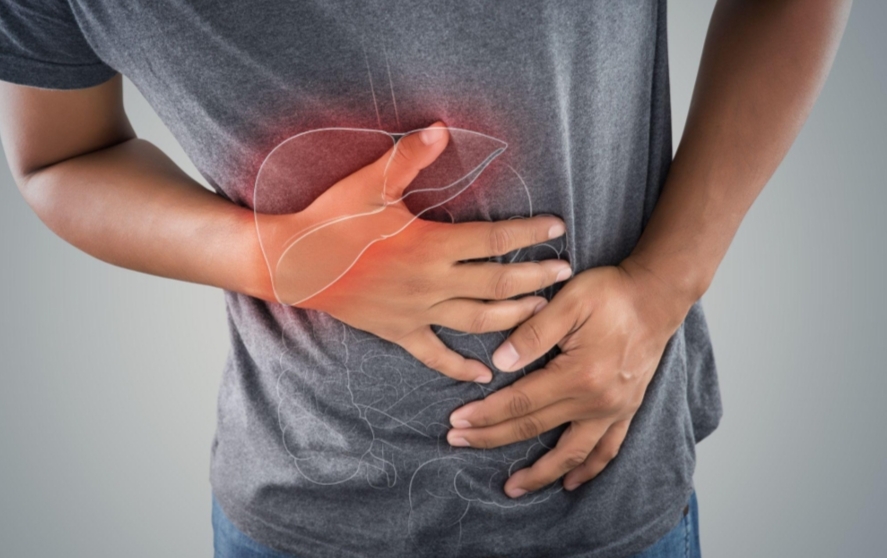 Mengenal Operasi Whipple di Dunia Medis, Jadi Harapan Pengobatan Pasien Kanker Pankreas