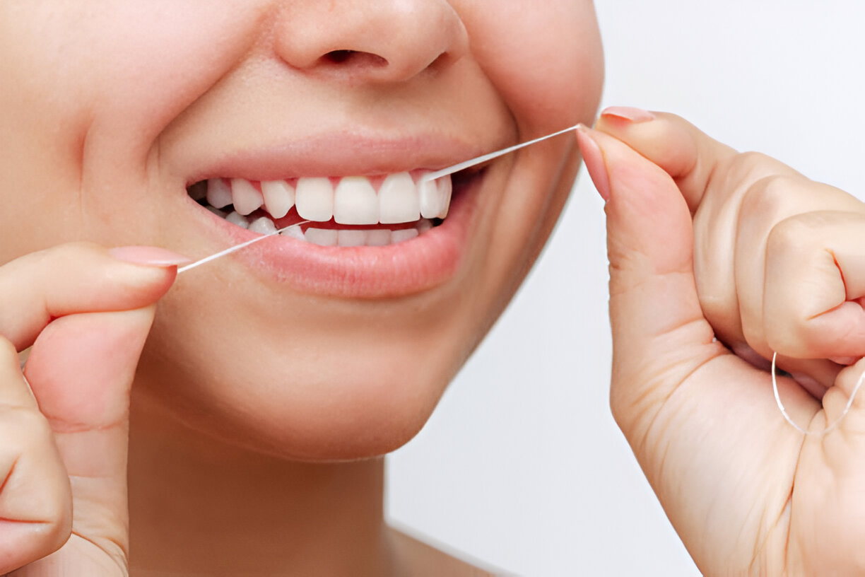 Sikat Gigi Saja Tidak Cukup, Saatnya Biasakan Flossing