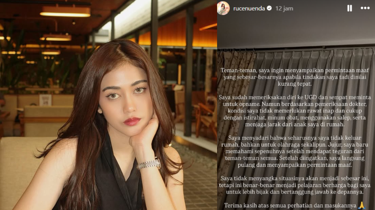 Influencer Ruce Nuenda Keluar Rumah saat Sakit Campak, Apakah Berbahaya dan Menular? Cek Faktanya