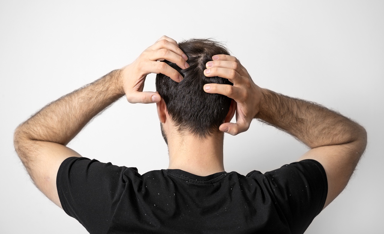 Peneliti Taiwan Temukan Serum Penumbuh Rambut Alami, Terbukti Bikin Rambut Tumbuh dalam 20 Hari