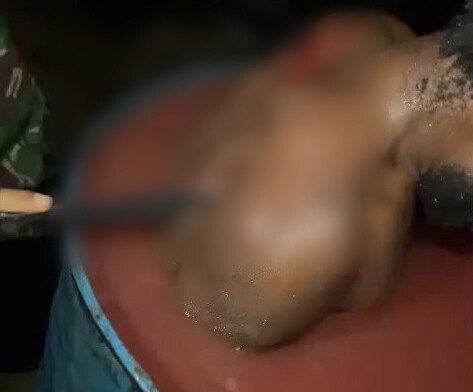Viral Video Penyiksaan Warga Sipil Yahukimo Diduga Dilakukan Aparat TNI Diunggah Aktivis OPM