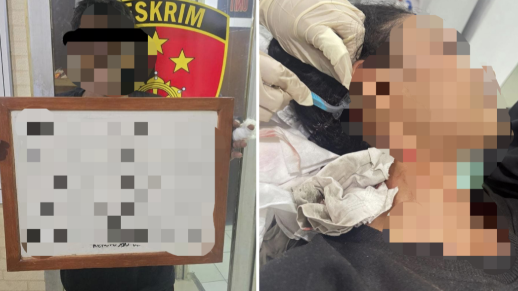 Begal Sadis Sayat Leher Perempuan di Tanah Abang, Korban Luka 20 Jahitan