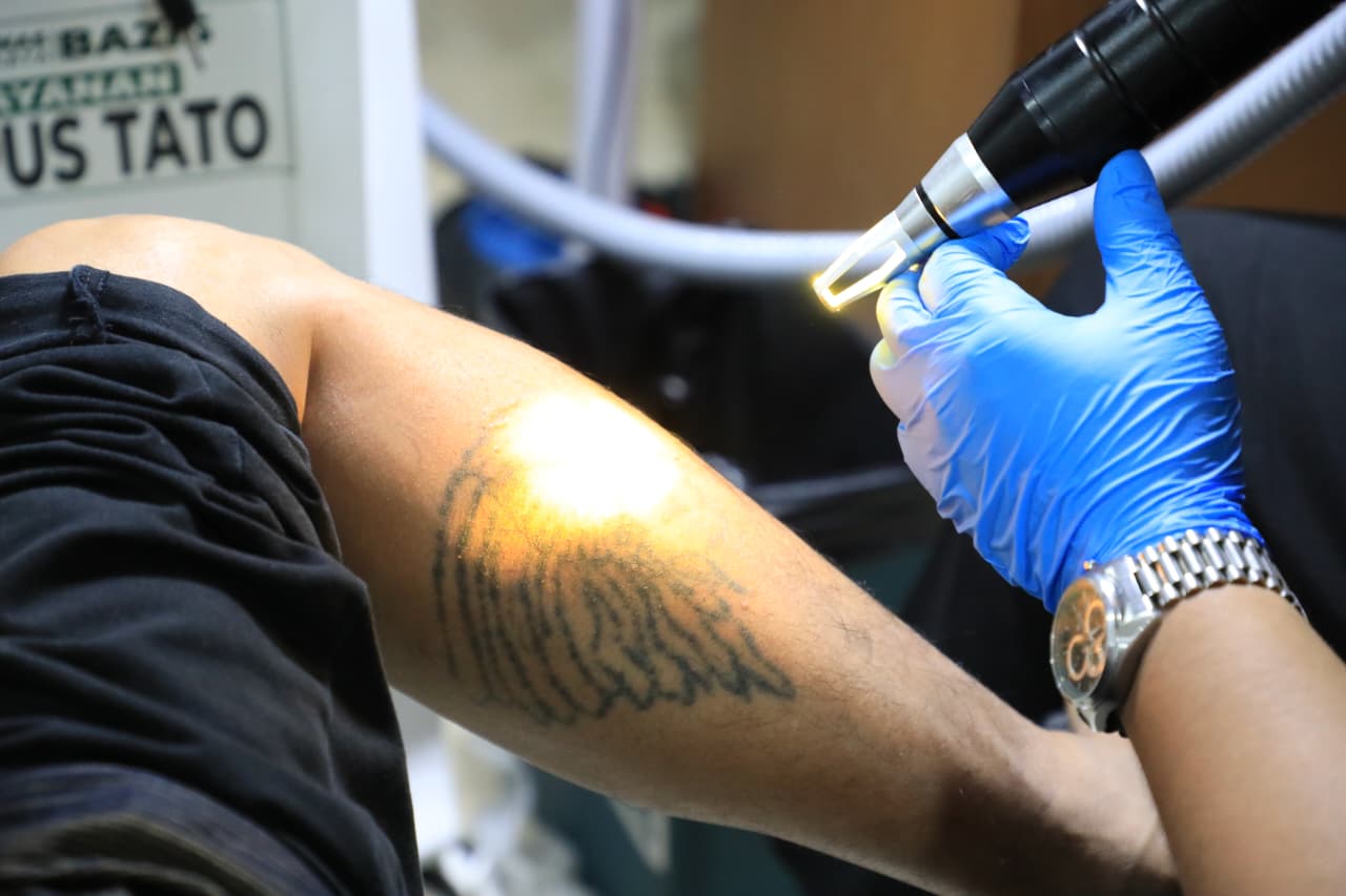 Momen Ramadan, Warga Antusias Ikuti Program Hapus Tato Gratis di Jaksel
