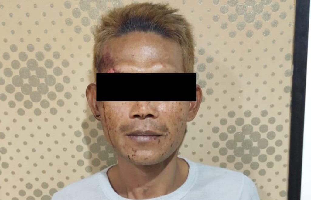 Pisah Ranjang 8 Bulan, Suami Nekat Siram Air Keras ke Istri Sirinya Gegara Cemburu Buta