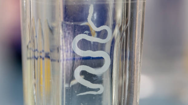 Bisakah Infeksi Cacingan yang Didalami Raya Menjalar Sampai ke Otak? Simak Penjelasan Dokter Ahli