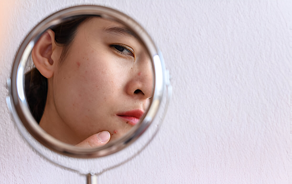 Cara Sederhana Menjaga Skin Barrier agar Tetap Sehat