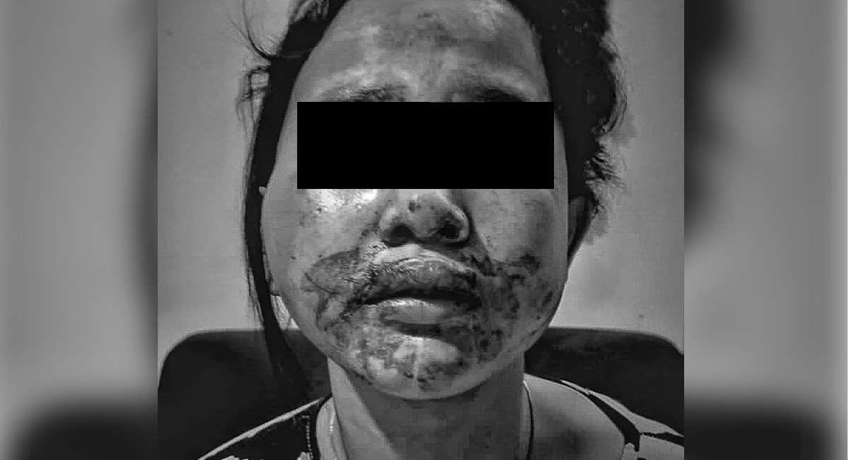 Brutal! Budyanto Tindih Tiara yang Tengah Hamil 4 Bulan saat Kabur Minta Pertolongan, Sang Ibunda Ikut Terkena Pukulan