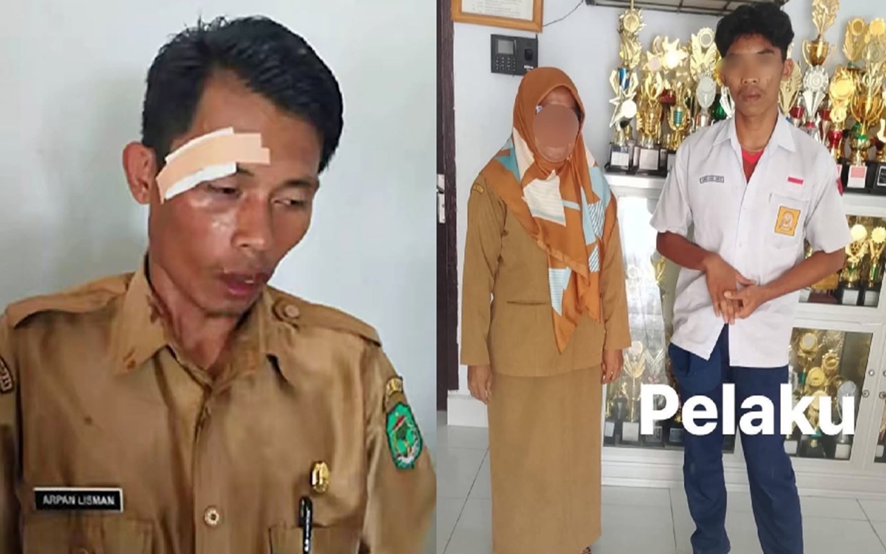 Miris! Niat Disiplin, Guru di Luwu Utara Jadi Korban Kekerasan Sampai Alis Kanannya Robek