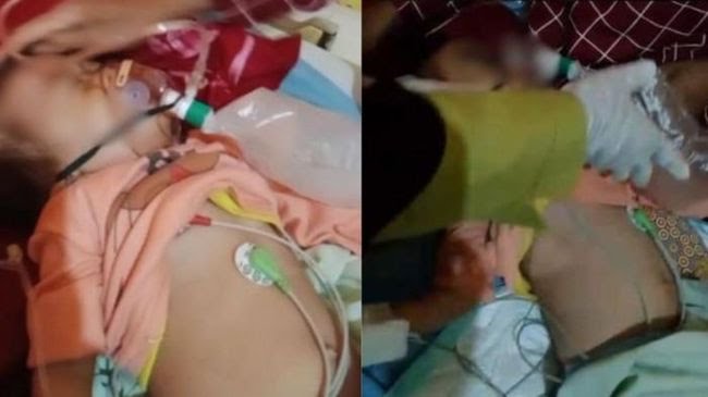 Kemendukbangga Beri Bantuan ke Bocah Penderita Cacingan di Bengkulu, Soroti Pentingnya Nutrisi dan Sanitasi