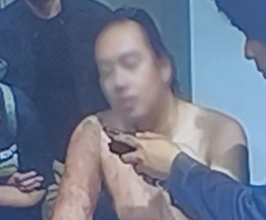 Andrie Yunus Tolak Kasusnya di Jalur Militer, Minta Didorong ke Peradilan Umum