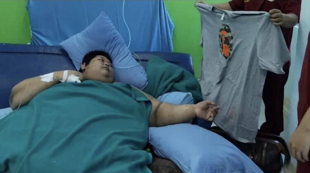Ini Keterangan RSCM Atas Meninggalnya Fajri, Pria Obesitas dengan Berat 300 Kg
