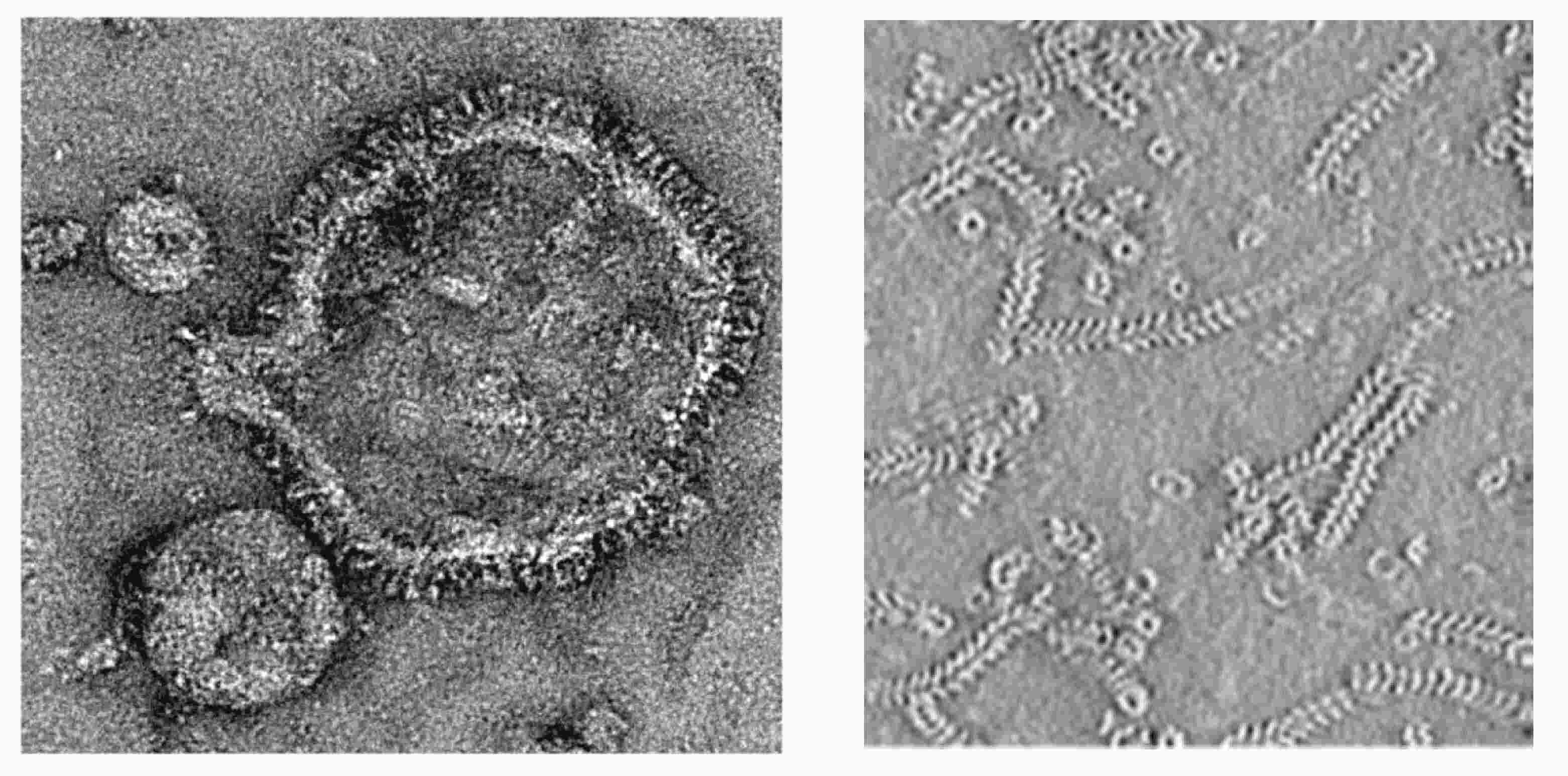 Tanggapi Wabah hMPV, Pakar Sarankan Cukup Lakukan 5M dan Gunakan Vaksin Flu