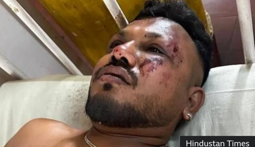 Kursi 11A Beri Keajaiban! Pria Ini Lolos dari Maut Saat Pesawat Air India Jatuh