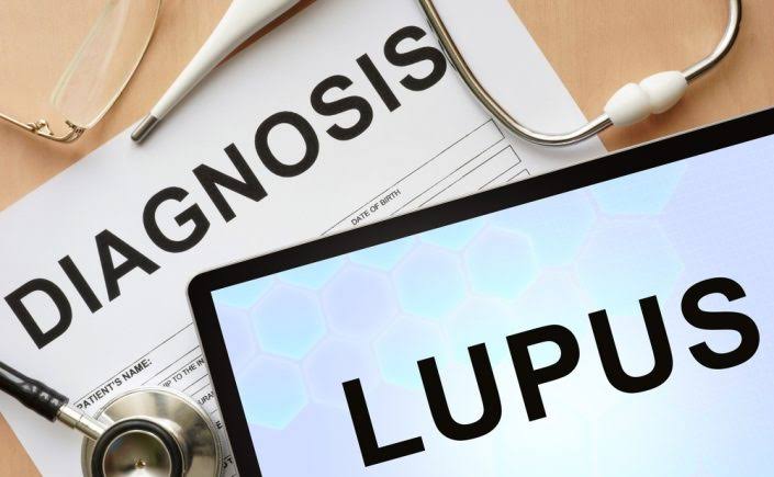 Ahli UI Ungkap Gejala dan Fakta Penting Lupus, Dikenal dengan Penyakit Seribu Wajah