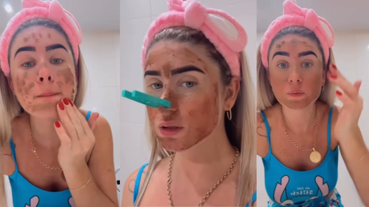 Viral Model Brasil Pakai Tinja untuk Masker Wajah, Bahayakah?