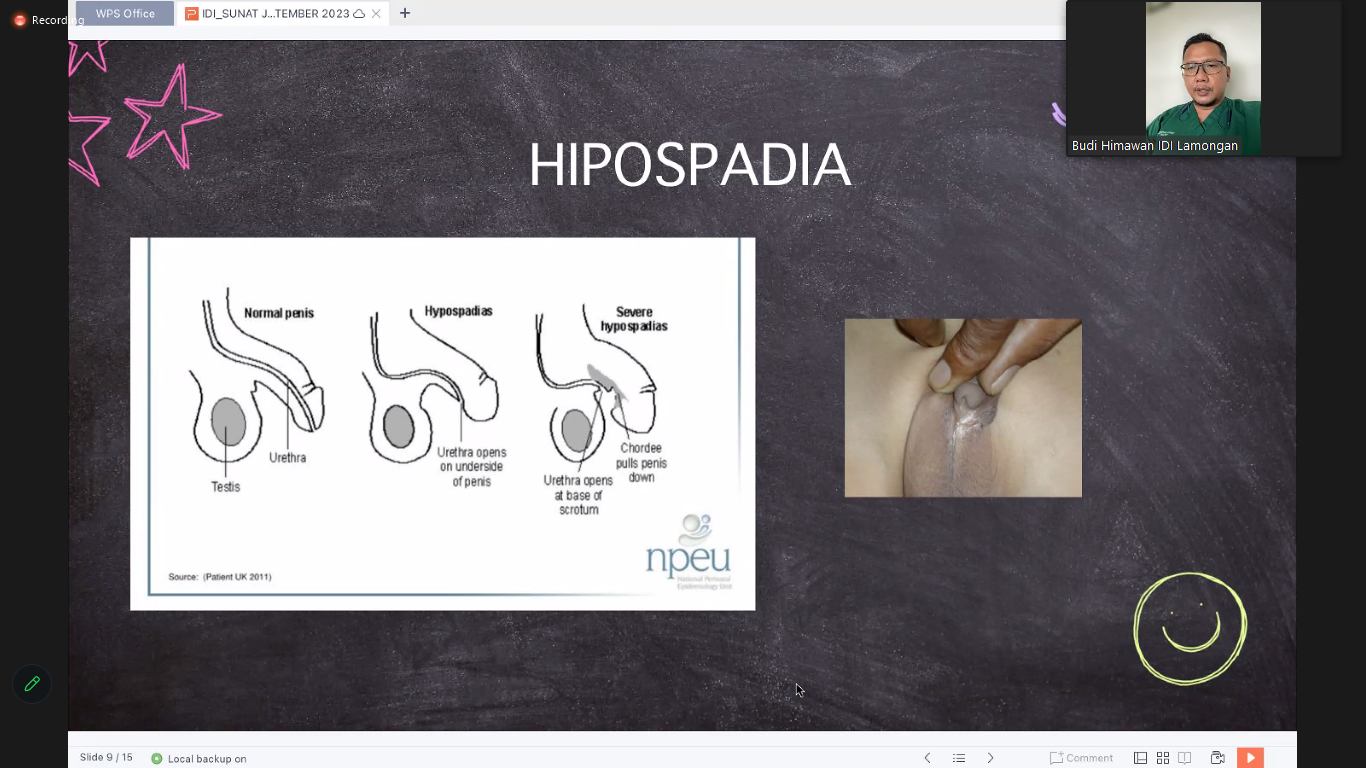 Ada Perbedaan Spesifik Antara Parafimosis dan Hipospadia yang Dapat Diketahui, Apa Saja?