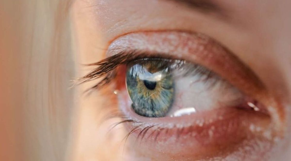 4 Penyebab Penglihatan Kabur saat Puasa dan Langkah Pencegahannya