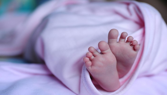 Viral Bayi Lahir dengan 4 Tangan dan 4 Kaki, Dianggap Sebagai Reinkarnasi Dewi Hindu