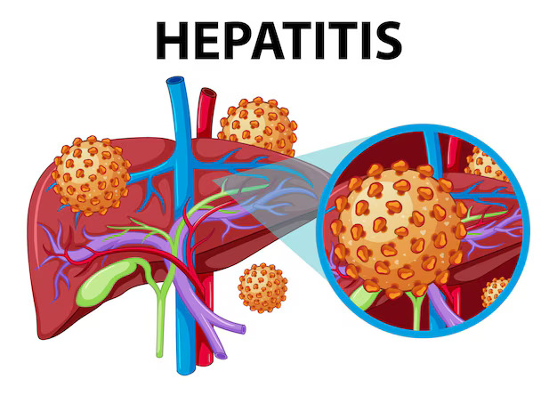 Menuju Hari Hepatitis Sedunia, Kemenkes Ajak Masyarakat Dukung Upaya Eliminasi Hepatitis Tahun 2030