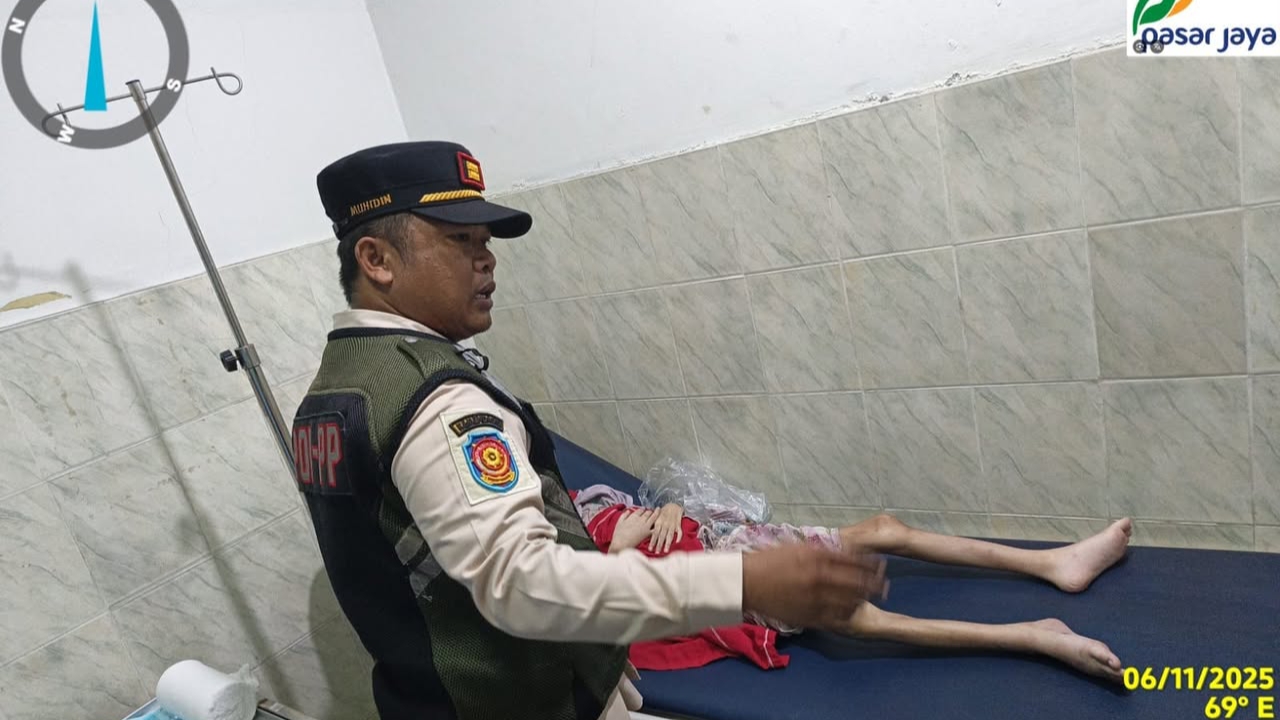 Bareskrim Ambil Alih Kasus Bocah Korban Penganiayaan di Kebayoran Lama