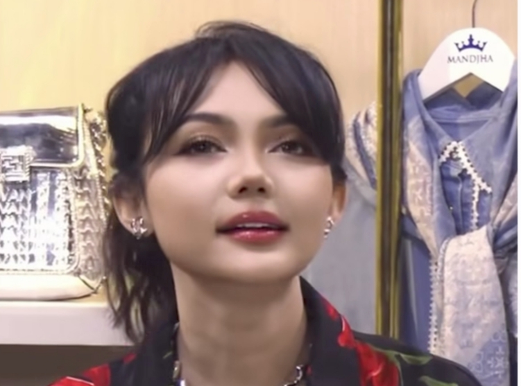 Heboh Rina Nose Disebut Lakukan Oplas Hidung dan Kelopak Mata, Wajahnya Bikin Pangling