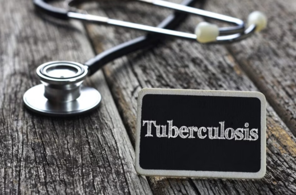 Terpapar Kuman Mycobacterium Tuberculosis Berisiko Sakit TBC, Wajib Ikut Terapi