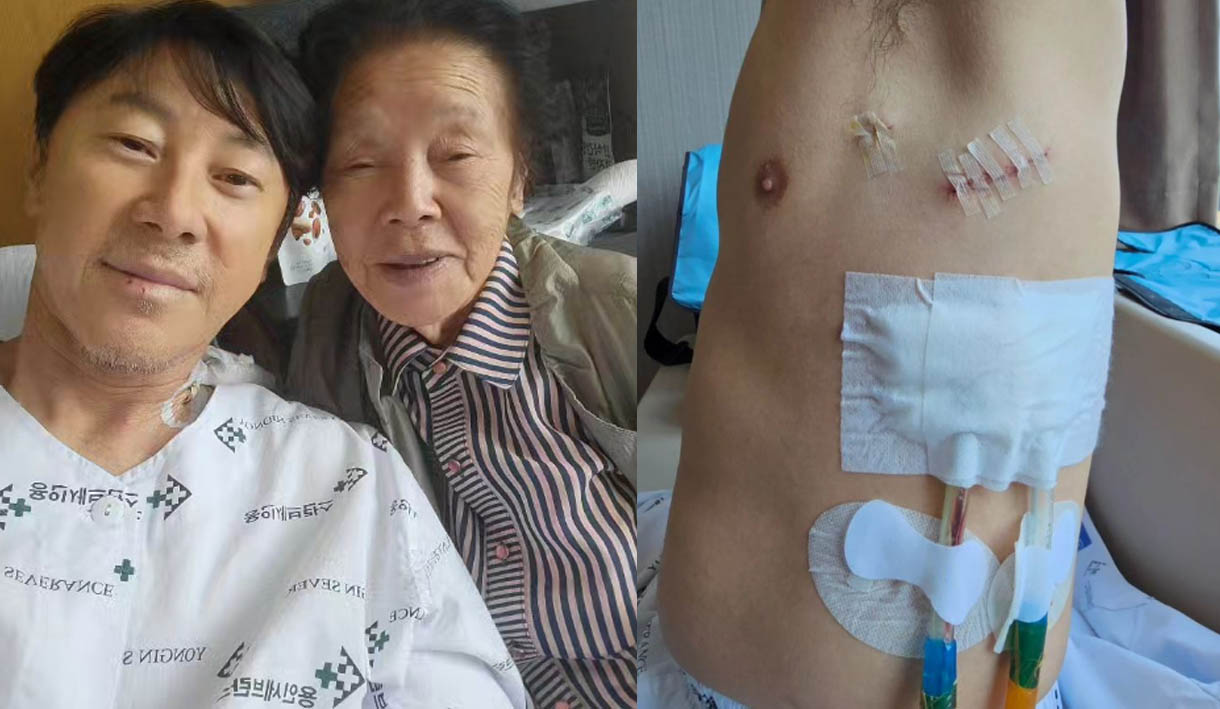 Shin Tae-yong Bagikan Foto Pasca Operasi di Korea Selatan, Bekas Jahitan Hingga Pasang Selang By Pas
