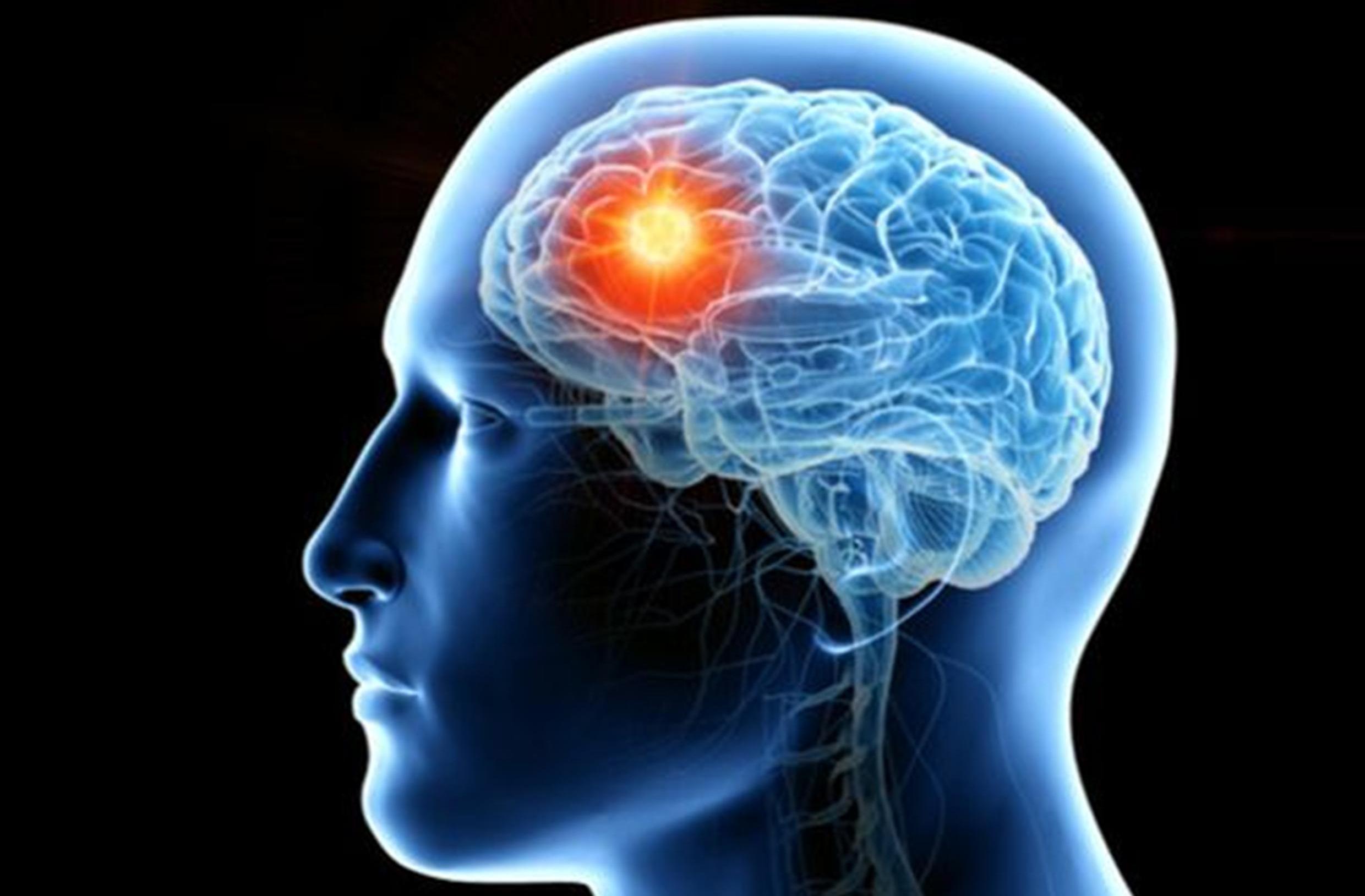 7 Penyebab Pikun dan Cara Mencegahnya