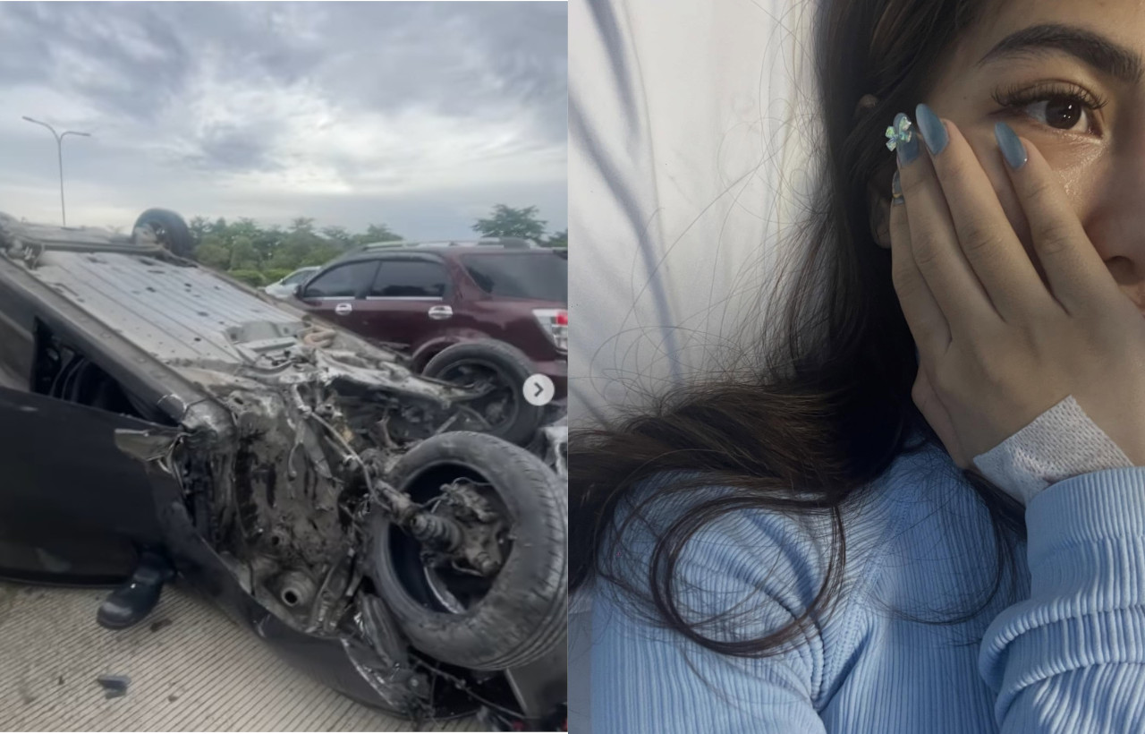 Model Diva Siregar Selamat dari Kecelakaan Maut di Tol, Dokter Sampai Terkejut!