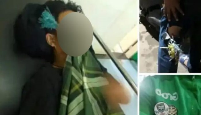 Beredar Foto Driver Ojol Tertusuk Anak Panah di Jalan Megawati, Benarkah?