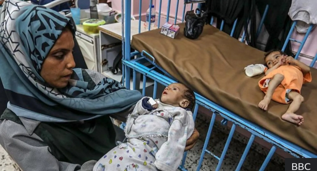 Anak-anak di Gaza Pingsan karena Kelaparan Seiring Meningkatnya Malnutrisi