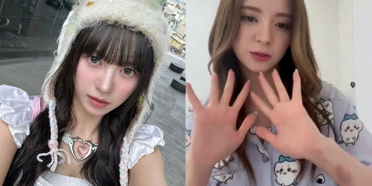 ⁠Mashiro MADEIN Bikin Fans Khawatir Karena Memar di Tangan, Isu Kekerasan Seksual Mencuat