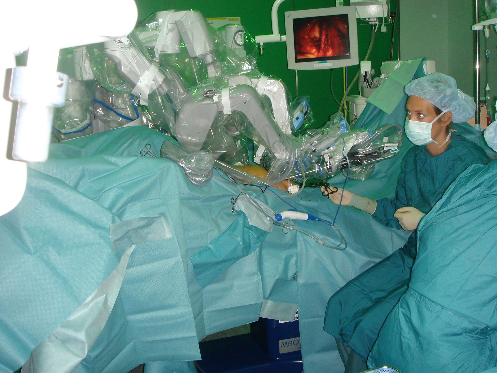 Robotic Surgery