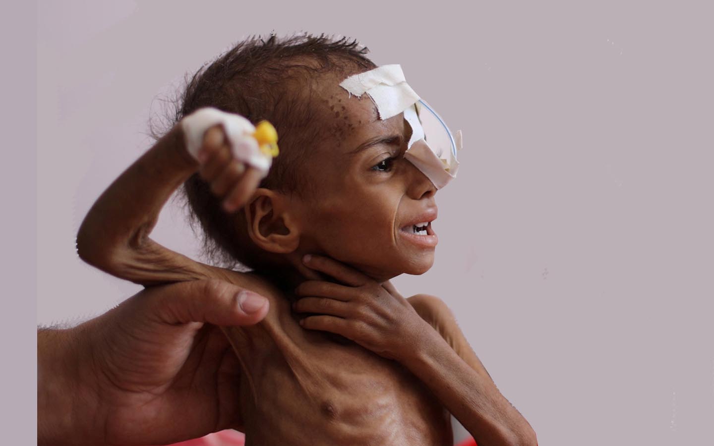 Cerita Jalal Si Penjual Roti: 17 Juta Warga Yaman Berjuang Memberi Makan Diri Sendiri
