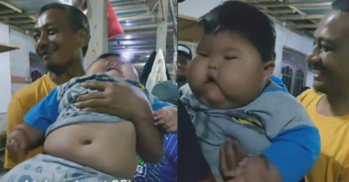 Setelah Viral Bayi 1 Tahun Berbobot 27 Kilogram, Ini Provinsi dengan Kasus Obesitas Anak Tertinggi