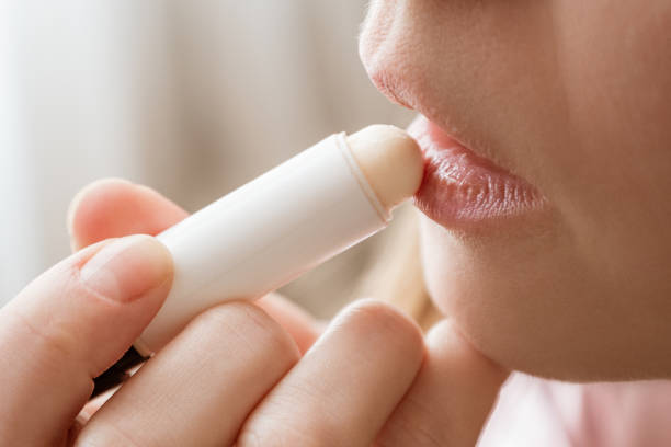 7 Rekomendasi Lip Balm untuk Mengatasi Bibir Kering