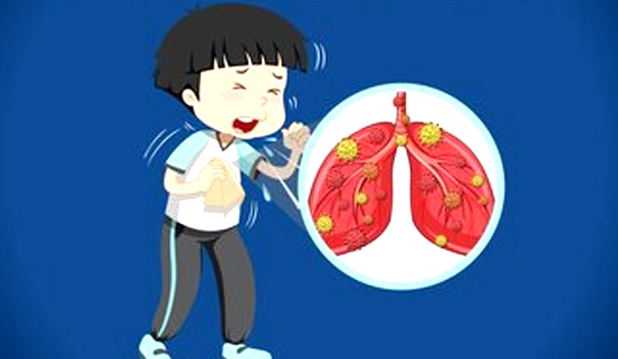 Ribuan Warga China Terserang Pneumonia, Sebagian Besar Anak-anak