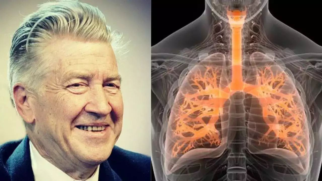 David Lynch Meninggal karena Emfisema, Penyakit Apakah Itu?