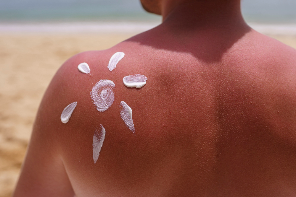 Mengenal SPF dan PA pada Sunscreen, Kunci Perlindungan Kulit dari Sinar UVA dan UVB