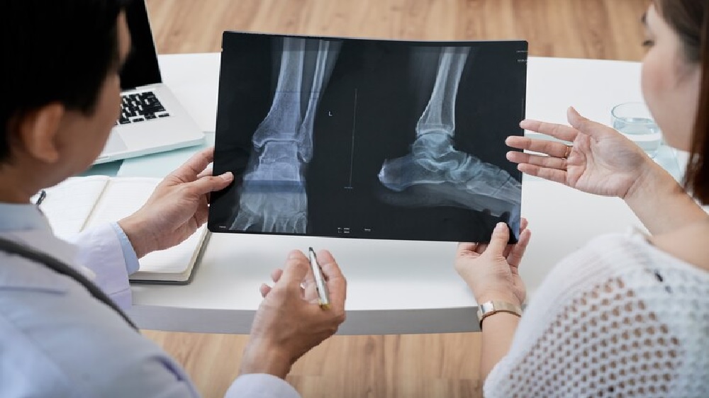 ﻿Ini Daftar Penyakit Tulang dan Sendi yang Bisa Ditangani di Layanan Ortopedi