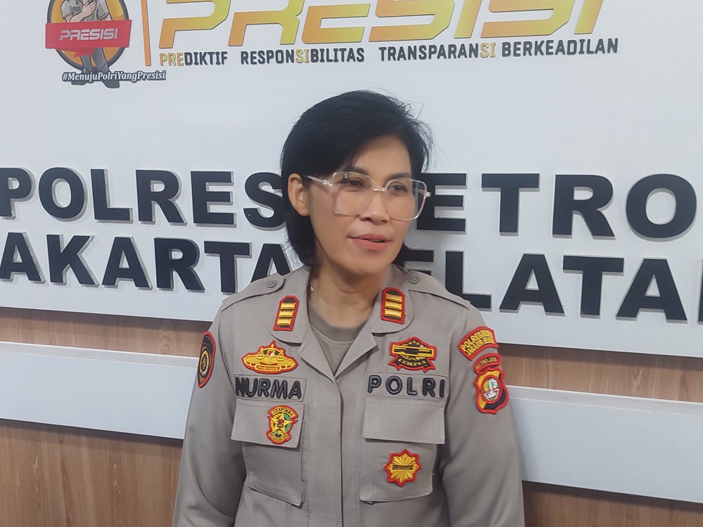 Hasil Visum Sementara Lolly Sudah Dikantongi Polisi, Vadel Badjideh Siap Dipanggil Jadi Saksi