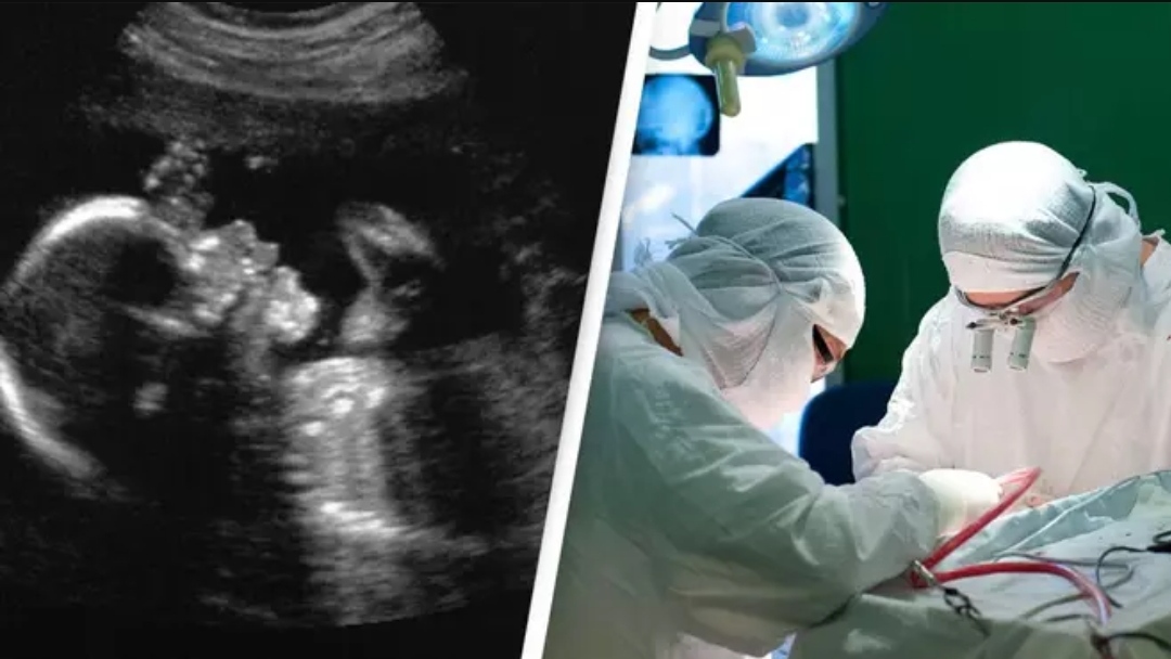 Inilah Operasi Otak Pertama yang Dilakukan Pada Bayi dari dalam Rahim