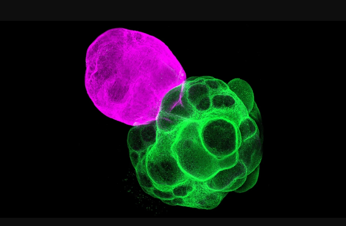 Peneliti Jepang Ciptakan Assembloid, Mini Sirkuit Otak Manusia