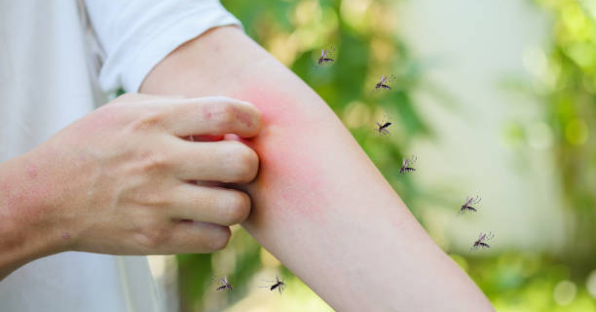 5 Tips Cegah Gigitan Nyamuk yang Efektif dan Mudah